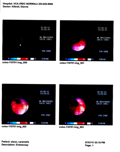 Endoscopy 1.jpg